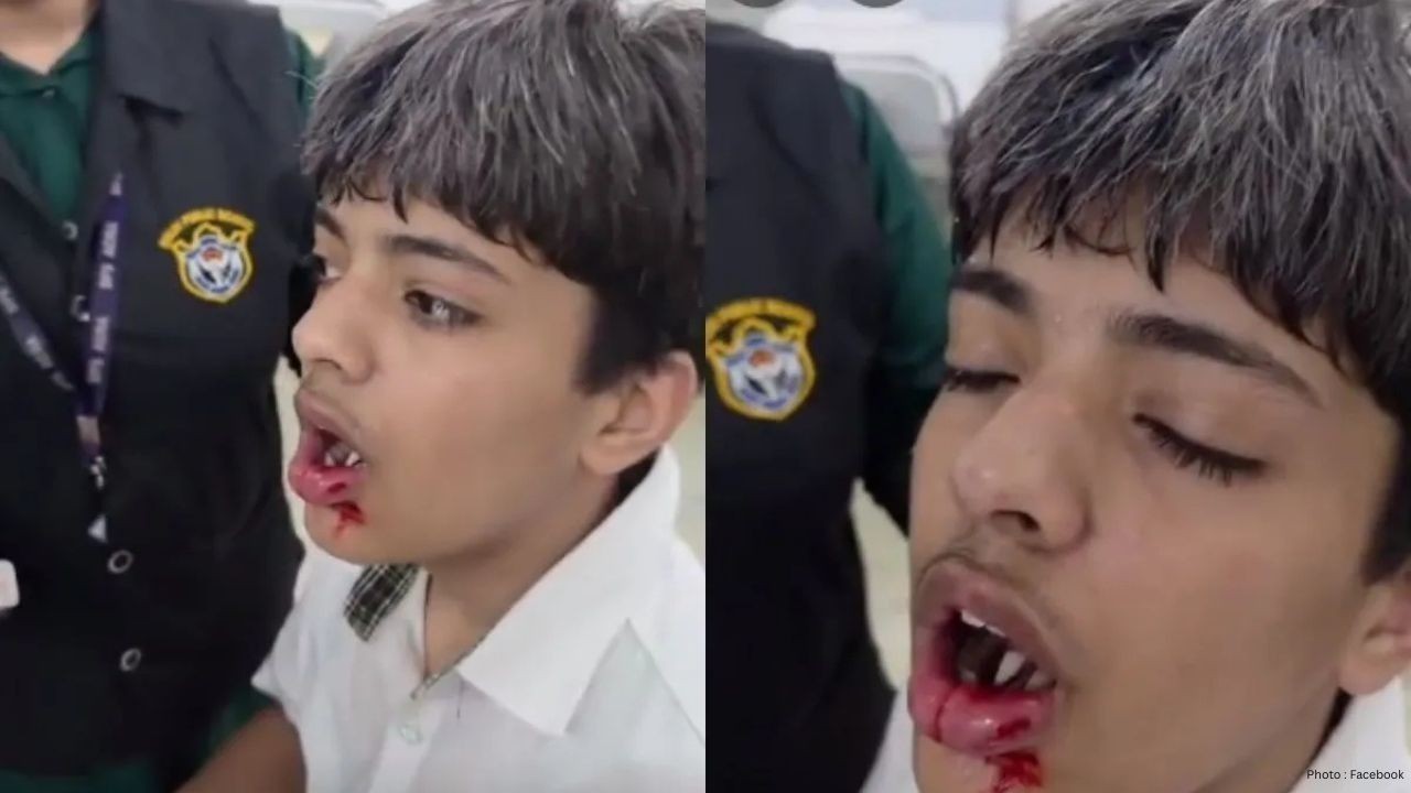 Agra School Assault: YouTuber’s Son Injured, Raises Safety Concerns